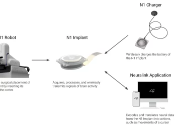 Neuralink’in Beyin İmplantında Sorun Raporlandı