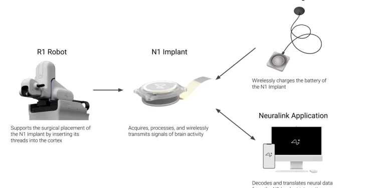 Neuralink’in Beyin İmplantında Sorun Raporlandı