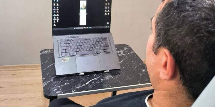 Türk Telekom’dan Kas Hastaları İçin Yapay Zeka Destekli Çözüm